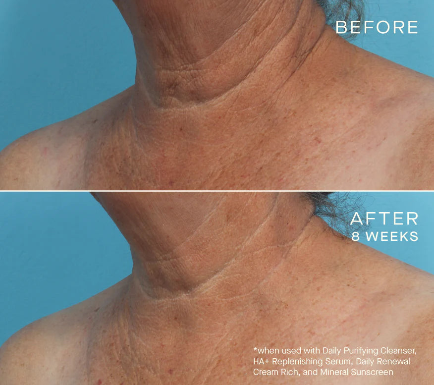 HA+ Replenishing Serum 15mL with Tiered-Release Vesicle™ Technology