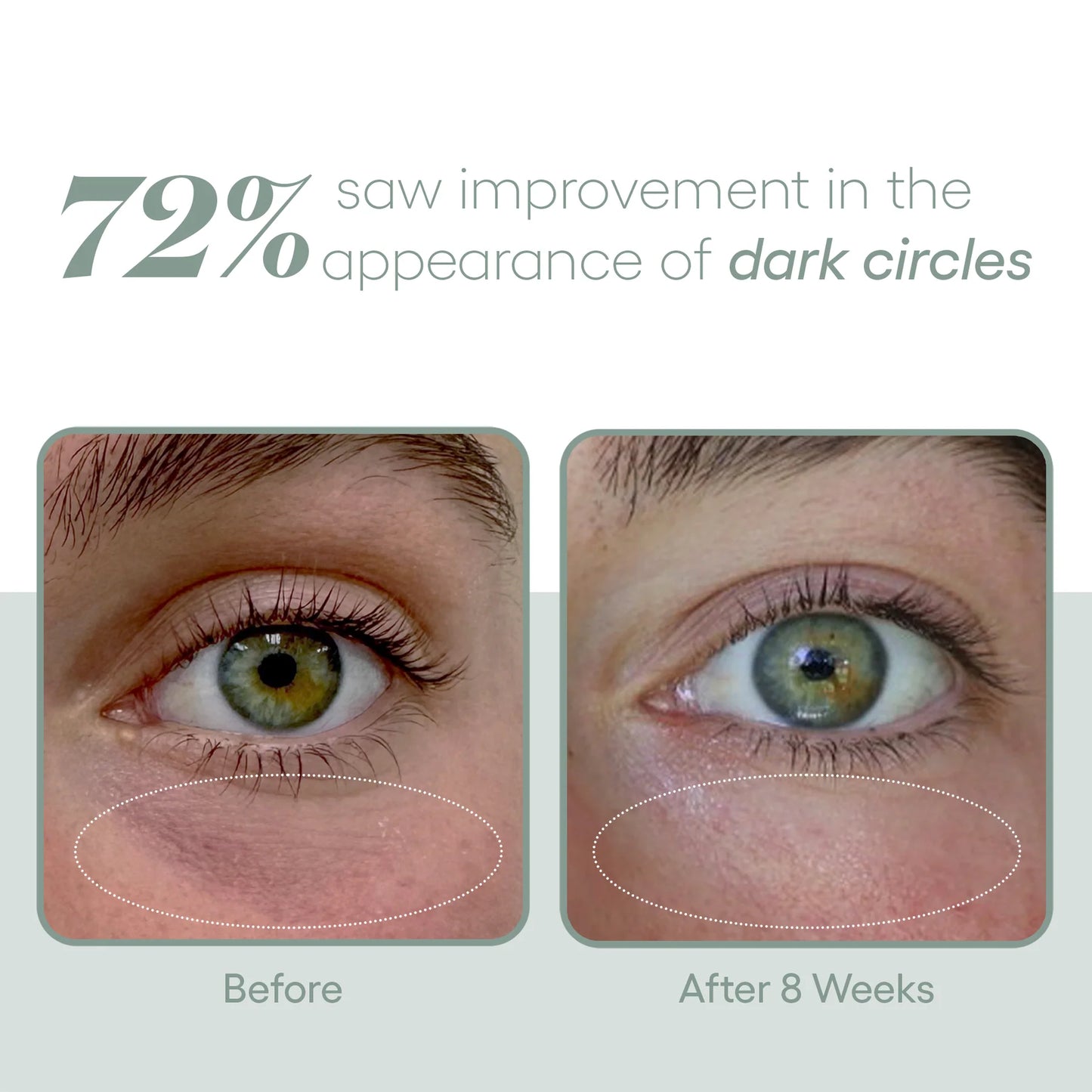 EYE Serum