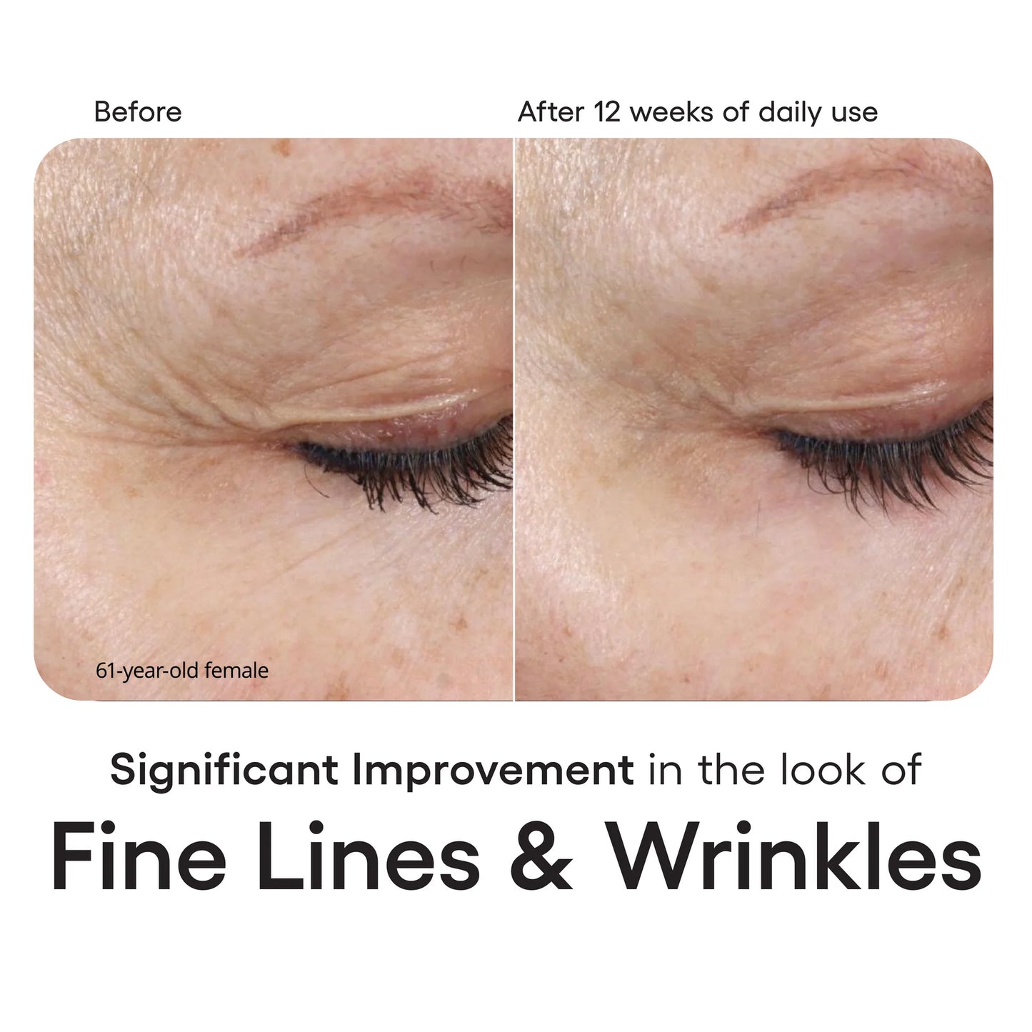 INTENSE Serum - Healthy Glow Aesthetics