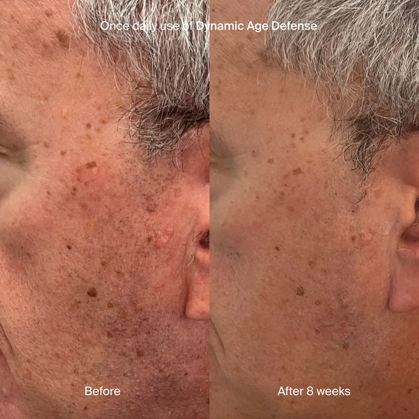 DYNAMIC AGE DEFENSE
