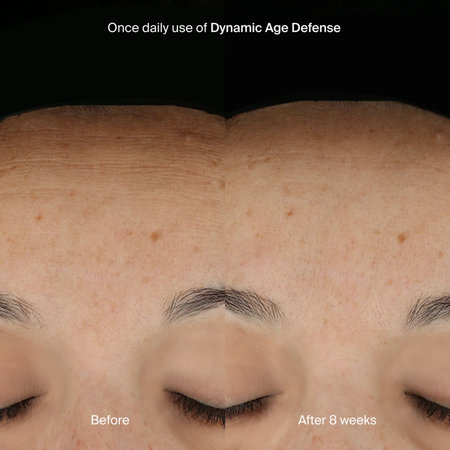 DYNAMIC AGE DEFENSE
