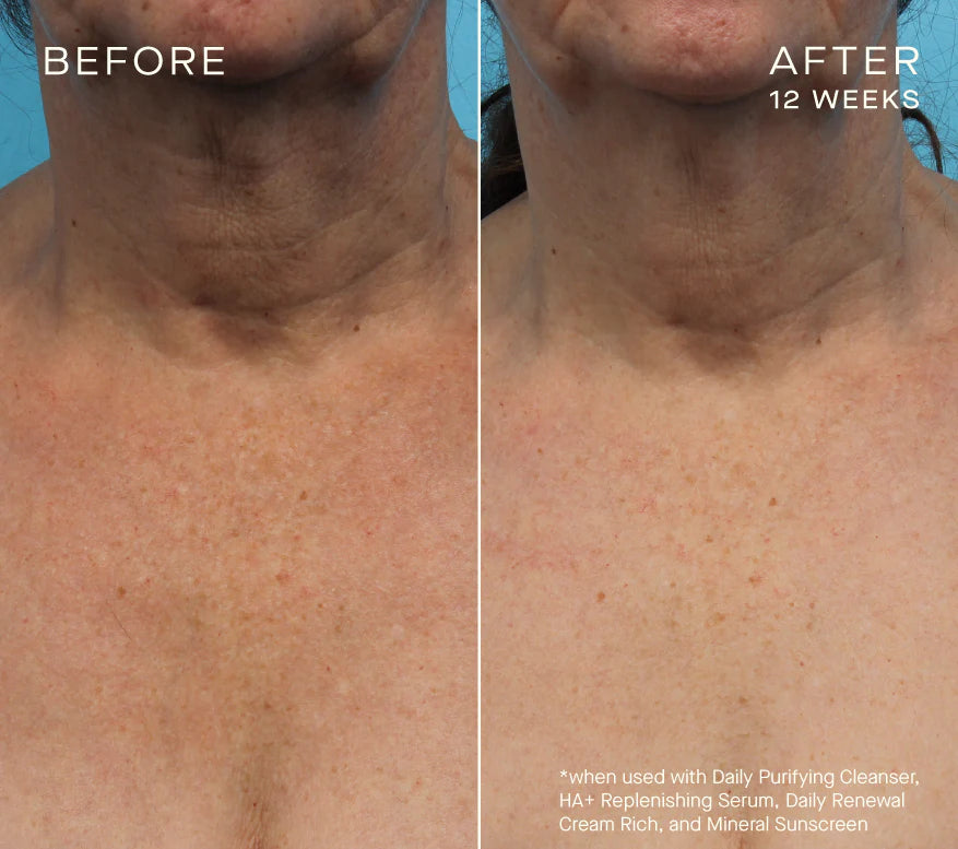 HA+ Replenishing Serum 15mL with Tiered-Release Vesicle™ Technology