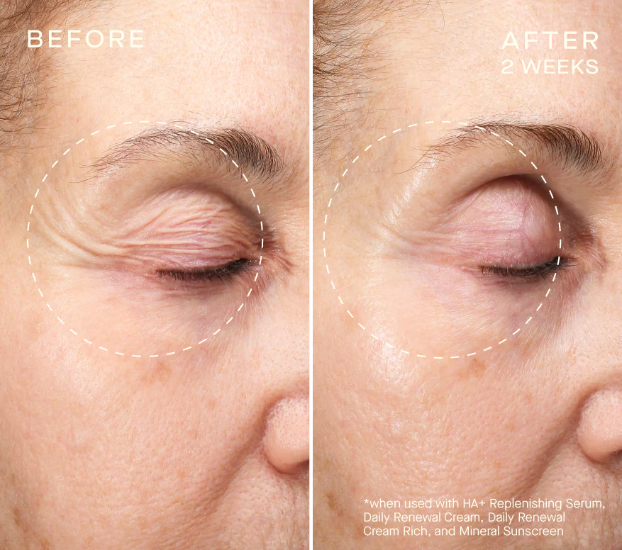 HA+ Replenishing Serum 15mL with Tiered-Release Vesicle™ Technology