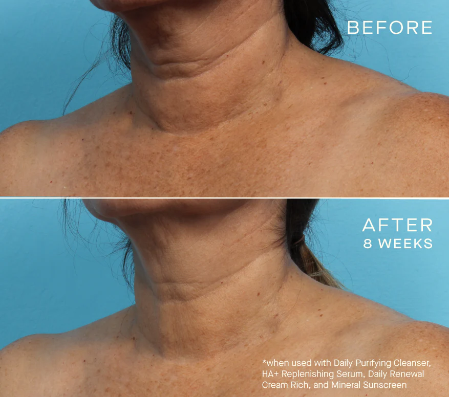 HA+ Replenishing Serum 15mL with Tiered-Release Vesicle™ Technology