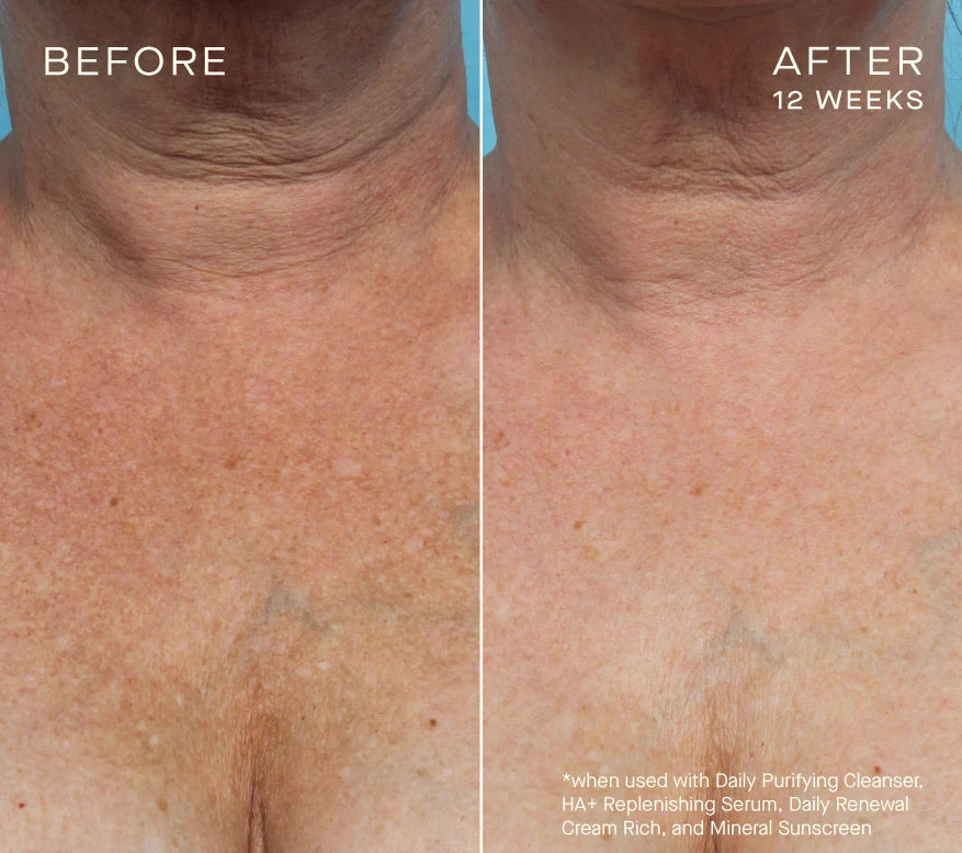 HA+ Replenishing Serum 15mL with Tiered-Release Vesicle™ Technology