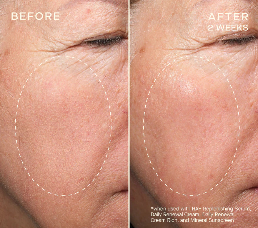 HA+ Replenishing Serum 15mL with Tiered-Release Vesicle™ Technology