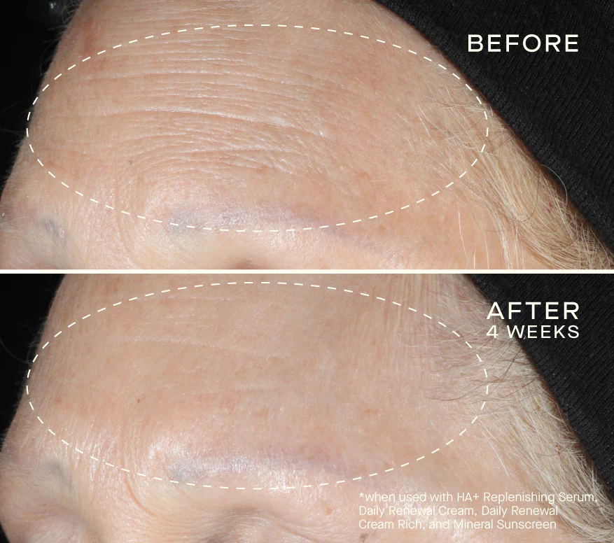 HA+ Replenishing Serum 15mL with Tiered-Release Vesicle™ Technology