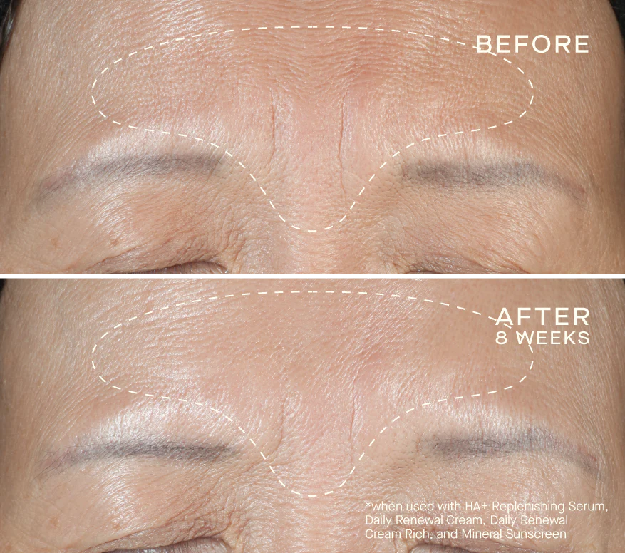 HA+ Replenishing Serum 15mL with Tiered-Release Vesicle™ Technology