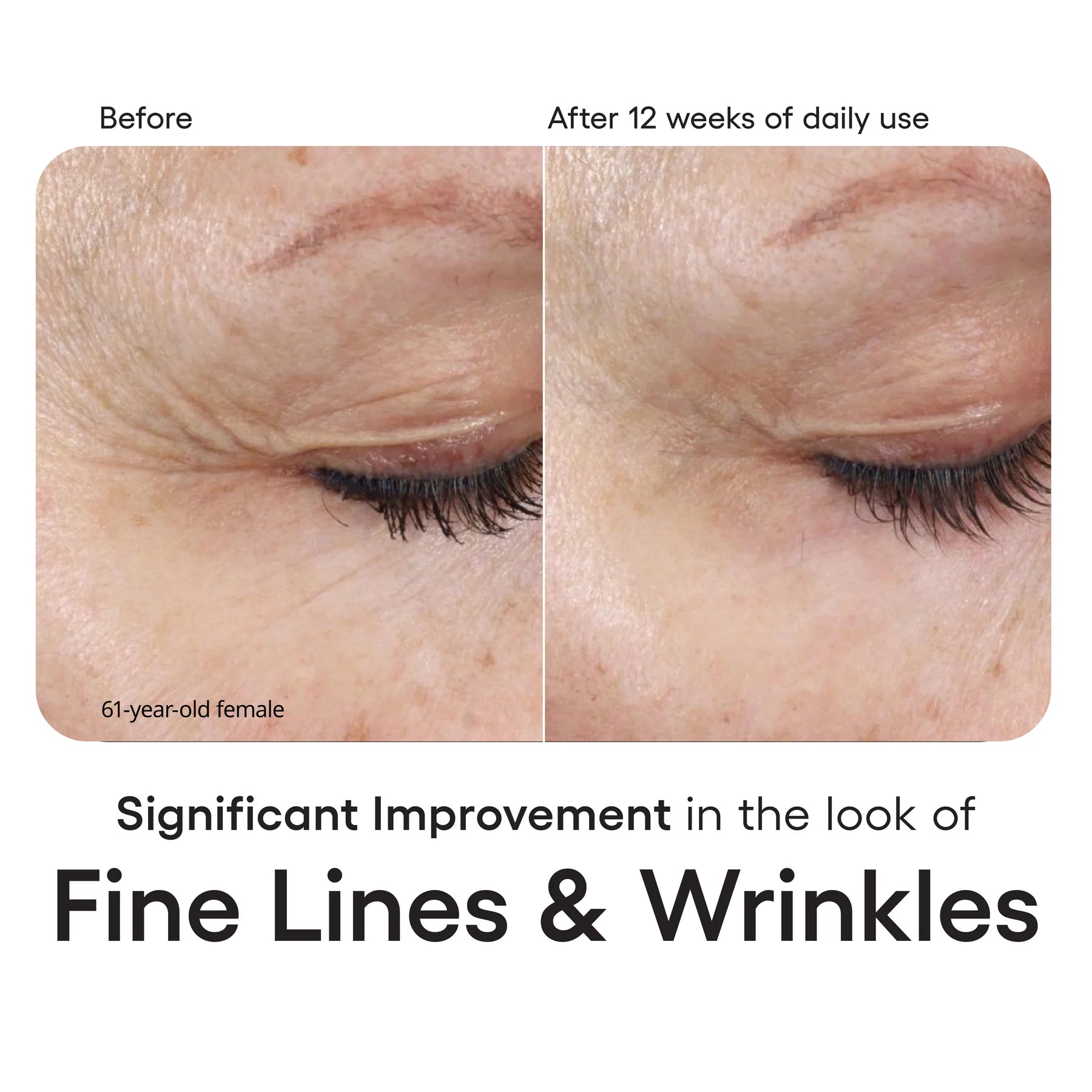 INTENSE Serum - Healthy Glow Aesthetics